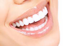 Can yellow teeth be whitened?