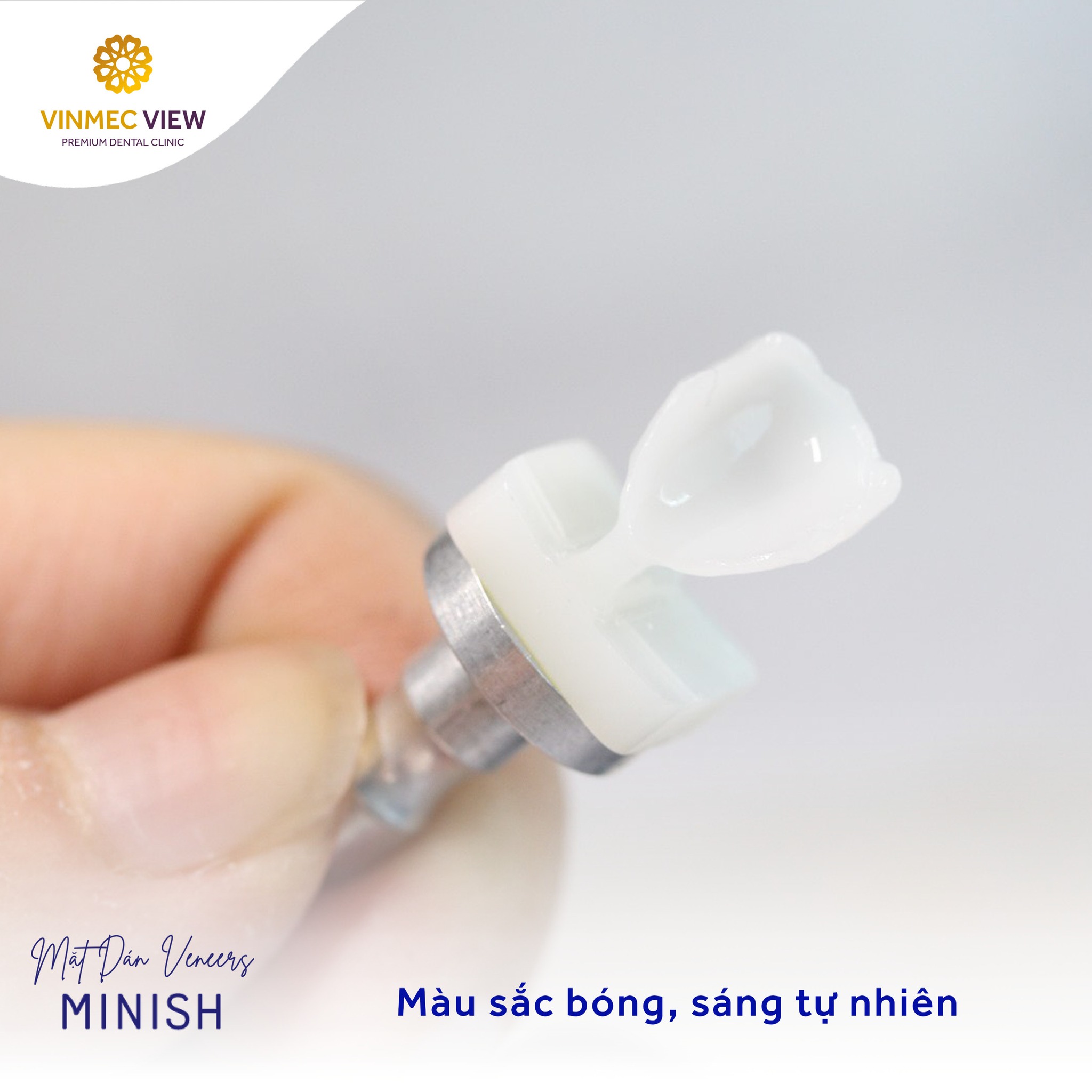 MINISH VENEERS – MỞ RA XU THẾ MỚI VỀ VENEERS SINH HỌC